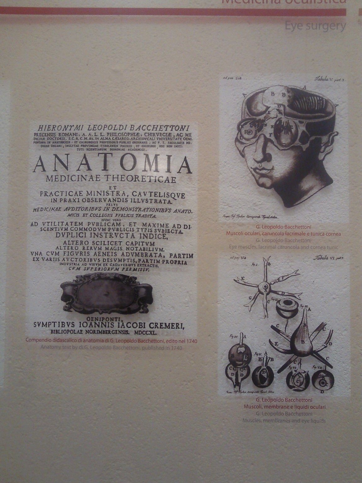 Museo chirurgia popolare Preci09.jpg